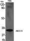 Putative ATP-binding cassette sub-family C member 13 antibody, A14867, Boster Biological Technology, Western Blot image 