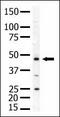 Phosphatidylinositol-5-Phosphate 4-Kinase Type 2 Alpha antibody, AP14966PU-N, Origene, Western Blot image 