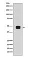 Glycogen Synthase Kinase 3 Beta antibody, P00791-1, Boster Biological Technology, Western Blot image 