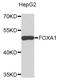 Forkhead Box A1 antibody, STJ111835, St John