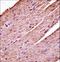 Pyruvate Dehydrogenase Kinase 3 antibody, LS-C164524, Lifespan Biosciences, Immunohistochemistry paraffin image 