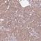 Stress-induced-phosphoprotein 1 antibody, HPA039291, Atlas Antibodies, Immunohistochemistry paraffin image 