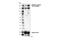 TSC Complex Subunit 2 antibody, 40729S, Cell Signaling Technology, Western Blot image 