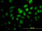 Protein Geranylgeranyltransferase Type I Subunit Beta antibody, LS-C133375, Lifespan Biosciences, Immunofluorescence image 