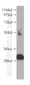 Toll Interacting Protein antibody, 11315-1-AP, Proteintech Group, Western Blot image 