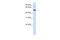 Ectonucleoside Triphosphate Diphosphohydrolase 8 antibody, A11751, Boster Biological Technology, Western Blot image 