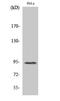 Signal Transducer And Activator Of Transcription 6 antibody, A00523T645-1, Boster Biological Technology, Western Blot image 