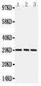 TNF Receptor Superfamily Member 4 antibody, GTX12387, GeneTex, Western Blot image 