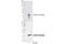 Complexin 1 antibody, 17700S, Cell Signaling Technology, Western Blot image 