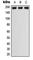 Platelet Derived Growth Factor Receptor Beta antibody, abx133055, Abbexa, Western Blot image 