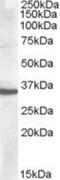 Apolipoprotein F antibody, NBP1-20882, Novus Biologicals, Western Blot image 