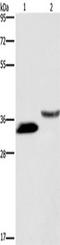 Growth Arrest Specific 1 antibody, TA351209, Origene, Western Blot image 