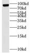 TNF Alpha Induced Protein 3 antibody, FNab08818, FineTest, Western Blot image 