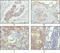 Activated Leukocyte Cell Adhesion Molecule antibody, abx015719, Abbexa, Enzyme Linked Immunosorbent Assay image 