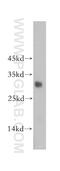 Sex Determining Region Y antibody, 17930-1-AP, Proteintech Group, Western Blot image 