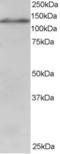Ubiquitin Specific Peptidase 11 antibody, LS-C55650, Lifespan Biosciences, Western Blot image 