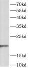 Adenosine Deaminase TRNA Specific 2 antibody, FNab00153, FineTest, Western Blot image 