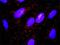 Myosin Light Chain Kinase antibody, H00004638-D01P, Novus Biologicals, Proximity Ligation Assay image 