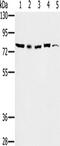 TGF-Beta Activated Kinase 1 (MAP3K7) Binding Protein 3 antibody, TA350153, Origene, Western Blot image 