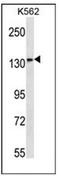 MN1 Proto-Oncogene, Transcriptional Regulator antibody, AP52715PU-N, Origene, Western Blot image 