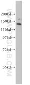 EH Domain Binding Protein 1 antibody, 17637-1-AP, Proteintech Group, Western Blot image 