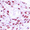 Minichromosome Maintenance Complex Component 4 antibody, LS-C352496, Lifespan Biosciences, Immunohistochemistry paraffin image 