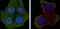 Phosphatase And Tensin Homolog antibody, GTX83304, GeneTex, Immunocytochemistry image 