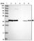 Eukaryotic Translation Initiation Factor 2B Subunit Beta antibody, HPA048028, Atlas Antibodies, Western Blot image 