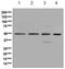 Eukaryotic Translation Initiation Factor 3 Subunit E antibody, ab134958, Abcam, Western Blot image 
