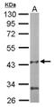 Pantothenate kinase 1 antibody, NBP1-32509, Novus Biologicals, Western Blot image 