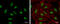 High Mobility Group AT-Hook 2 antibody, GTX100519, GeneTex, Immunofluorescence image 
