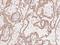 Small Cell Adhesion Glycoprotein antibody, 205844-T08, Sino Biological, Immunohistochemistry paraffin image 