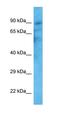 Transient Receptor Potential Cation Channel Subfamily V Member 2 antibody, orb329822, Biorbyt, Western Blot image 