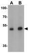 FOXP3 antibody, GTX31517, GeneTex, Western Blot image 