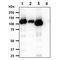 Hexokinase 3 antibody, GTX57726, GeneTex, Western Blot image 