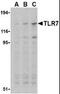 Toll Like Receptor 7 antibody, MBS395670, MyBioSource, Western Blot image 