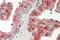 Acid Phosphatase, Prostate antibody, NBP1-51946, Novus Biologicals, Immunohistochemistry paraffin image 