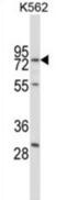 Replication Protein A1 antibody, abx028041, Abbexa, Western Blot image 