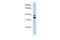 Msh Homeobox 2 antibody, PA5-40367, Invitrogen Antibodies, Western Blot image 