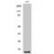 Fragile Histidine Triad Diadenosine Triphosphatase antibody, LS-C383488, Lifespan Biosciences, Western Blot image 