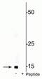 Cytochrome C Oxidase Subunit 4I1 antibody, P05442, Boster Biological Technology, Western Blot image 