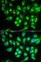 Solute Carrier Family 22 Member 5 antibody, LS-B13366, Lifespan Biosciences, Immunofluorescence image 