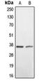 BCL2 Interacting Protein 2 antibody, orb213611, Biorbyt, Western Blot image 