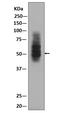 Solute Carrier Family 2 Member 1 antibody, M00163, Boster Biological Technology, Western Blot image 