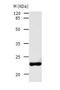 Adenylate Kinase 1 antibody, TA321143, Origene, Western Blot image 