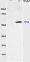 Sterol O-Acyltransferase 2 antibody, GTX60244, GeneTex, Western Blot image 