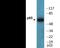 p65 antibody, EKC2479, Boster Biological Technology, Western Blot image 