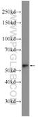 Acyl-CoA Synthetase Family Member 2 antibody, 16140-1-AP, Proteintech Group, Western Blot image 