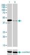 Paired Box 5 antibody, H00005079-M01, Novus Biologicals, Western Blot image 