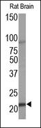 Endothelin 1 antibody, 250633, Abbiotec, Western Blot image 